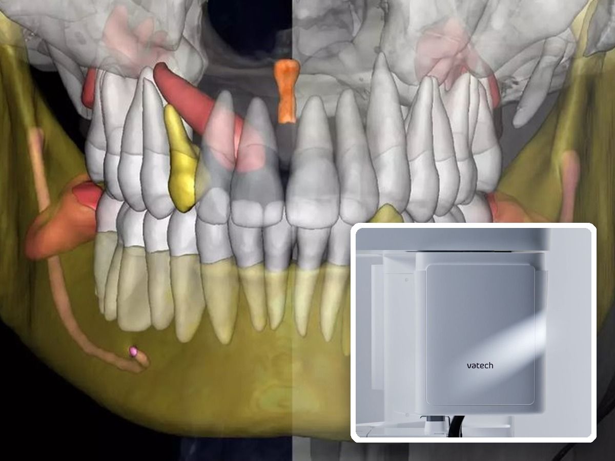 Advanced 3D imaging technology and Vatech CBCT scanner