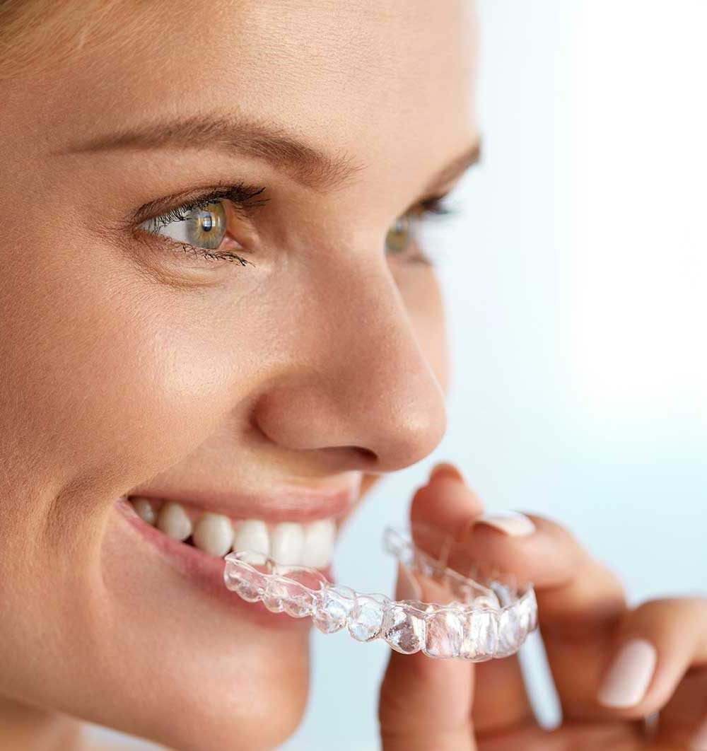Smile after whitening